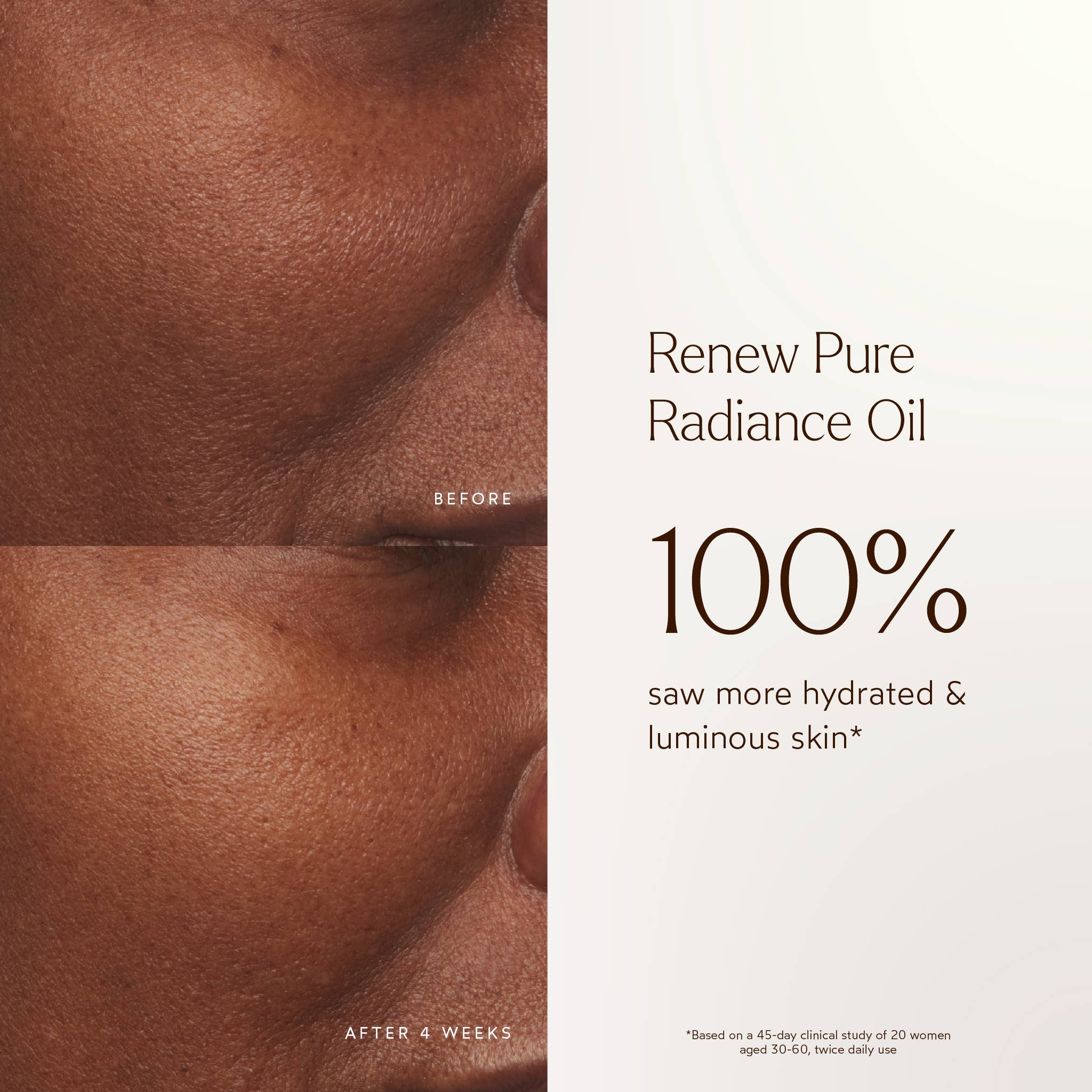Renew Pure Radiance Hydrating Facial Oil: Full Size (1 fl oz | 30 ml)