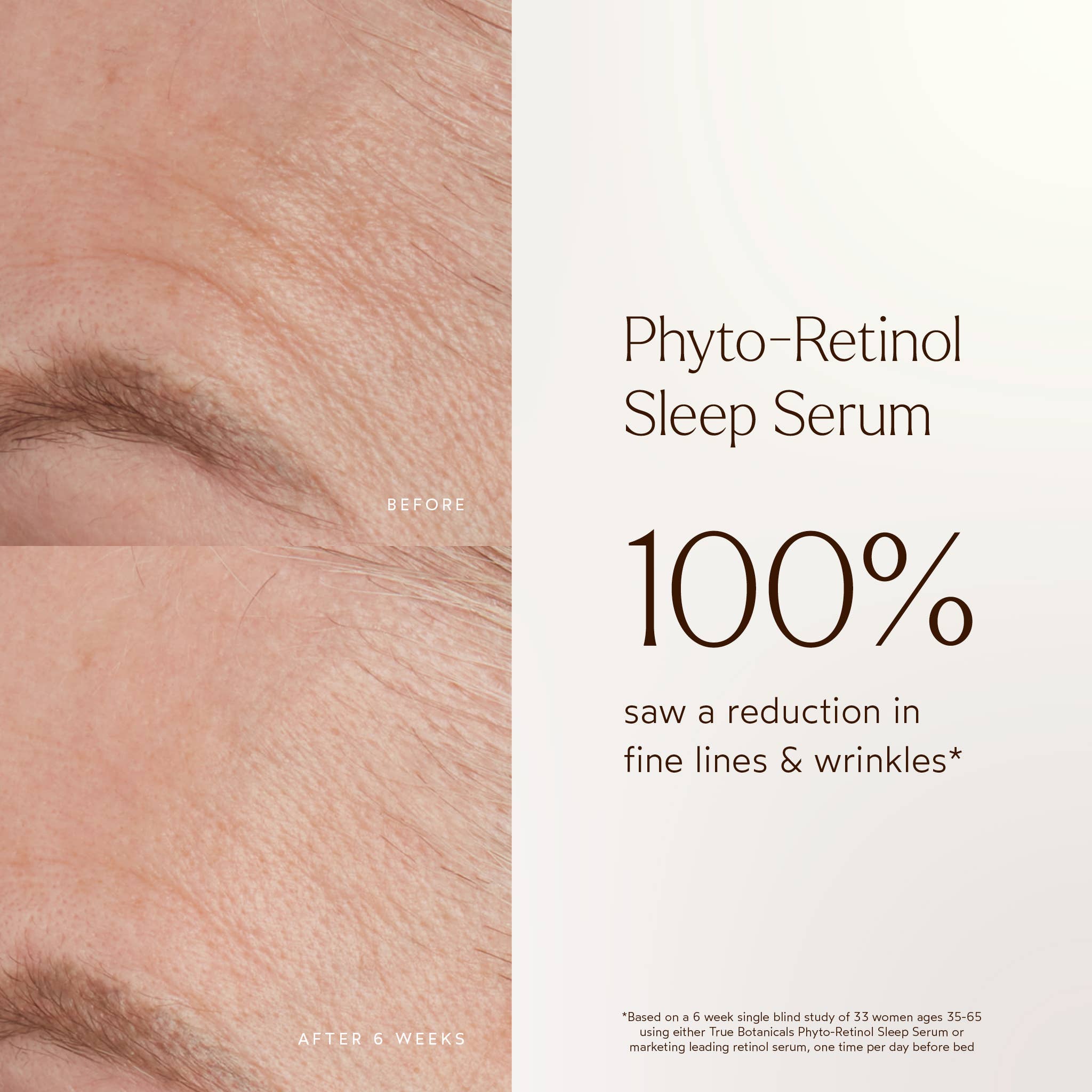 Phyto Retinol Anti-Aging Sleep Treatment: Full Size (1 fl oz | 30 ml)