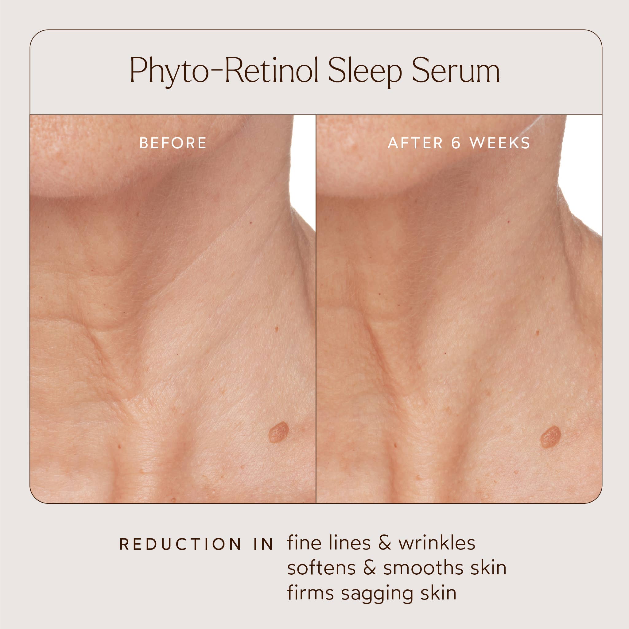 Phyto Retinol Anti-Aging Sleep Treatment: Full Size (1 fl oz | 30 ml)
